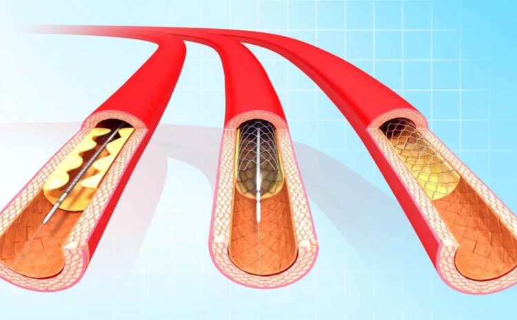 best cardiologist in indore