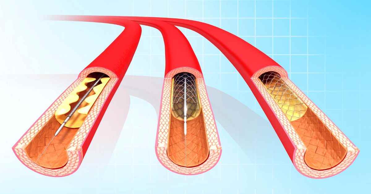 best cardiologist in indore