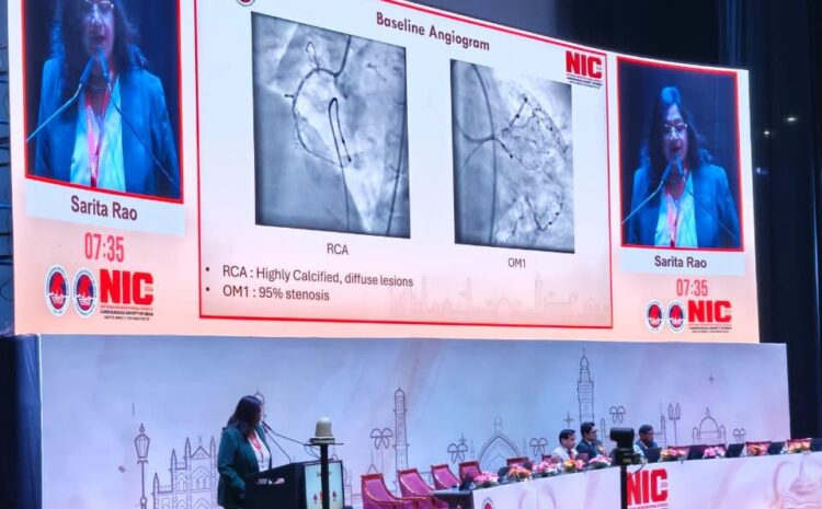 Calcified Coronary Lesions Treatment in India