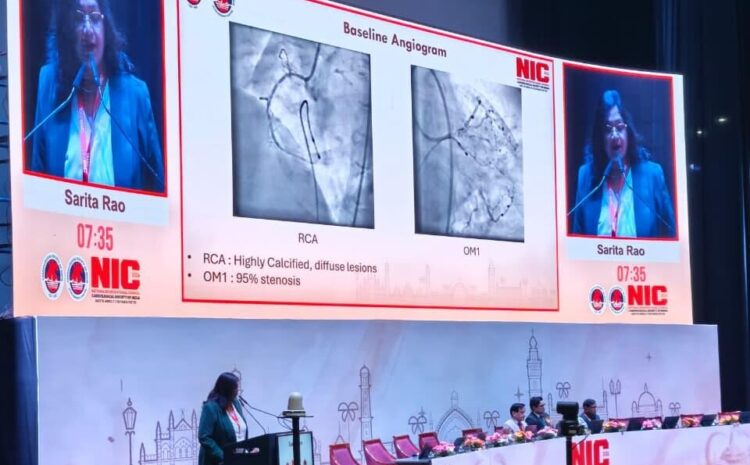 Calcified Coronary Lesions Treatment in India