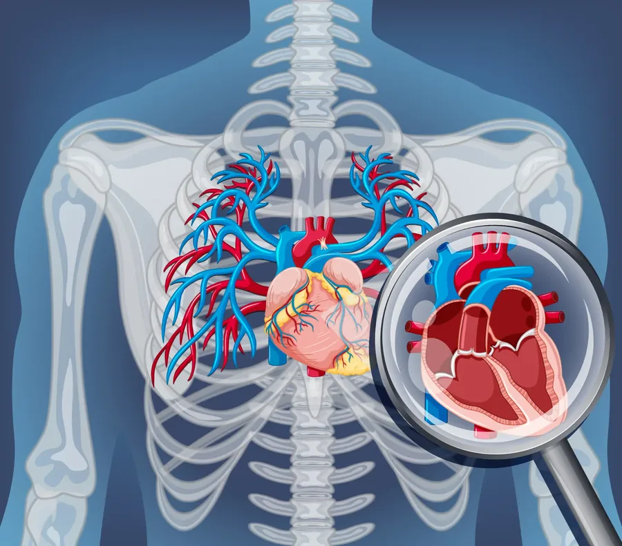 Renal_Denervation_