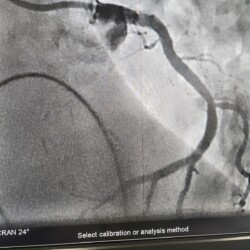 Best Women Cardiologist in India