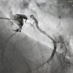 Best Women Cardiologist in India
