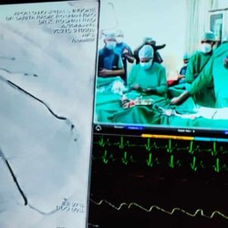 Best Interventional Cardiologist in India