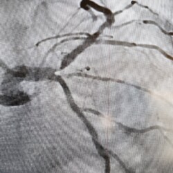 Best Women Cardiologist in India