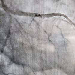 Best Women Cardiologist in India