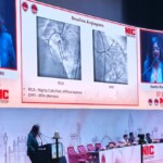 Calcified Coronary Lesions Treatment in India